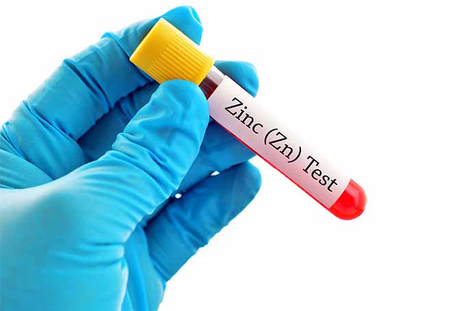 A blood test administered by a doctor will show if you suffer from a zinc deficiency. | Foodal.com